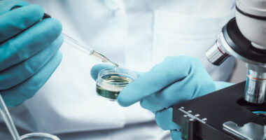 cell therapy and RDEB