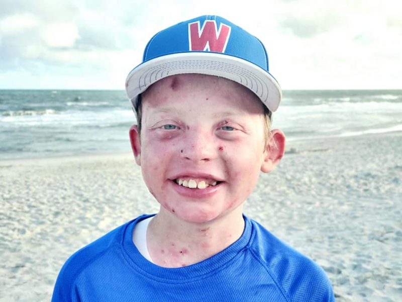 Jonah wears a baseball cap and smiles on the beach.