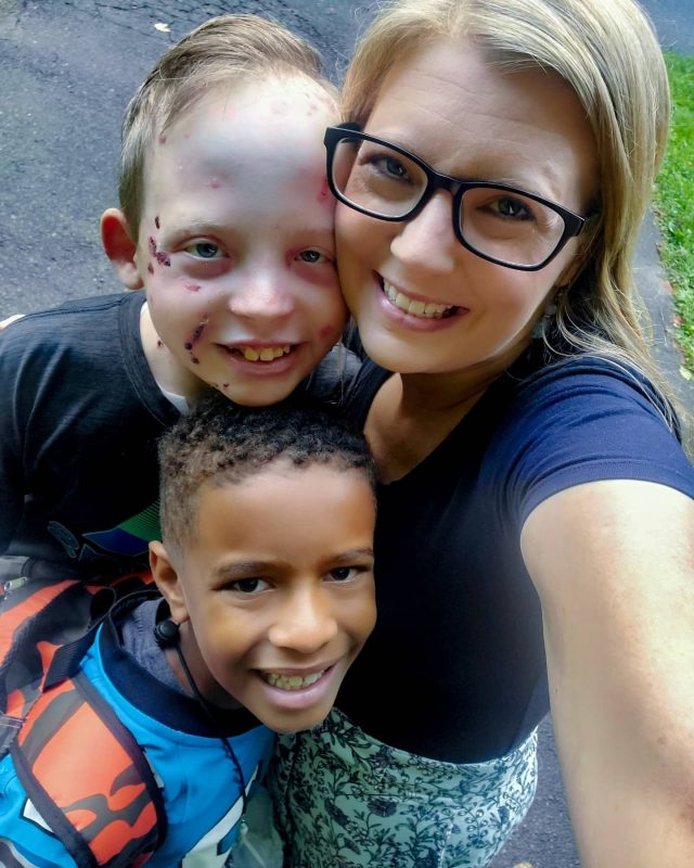 School and EB | Epidermolysis Bullosa News | Patrice, Jonah, and Gideon take a selfie on the boys' first day of school.