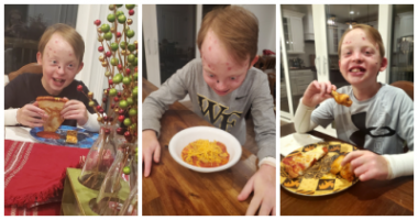 oral surgery and EB | Epidermolysis Bullosa News | A three-photo collage of Jonah enjoying his favorite foods again