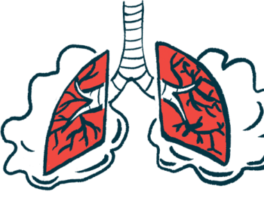 junctional epidermolysis bullosa | Epidermolysis Bullosa News | illustration of the lungs