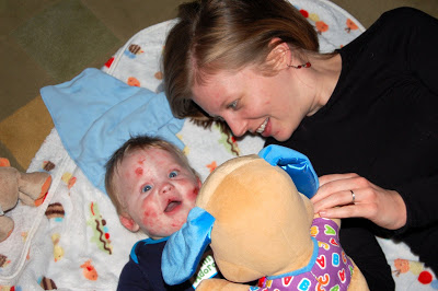 miracle | Epidermolysis Bullosa News Today | Patrice and Jonah play with a large stuffed animal on a blanket on the floor several years ago when Jonah was an infant