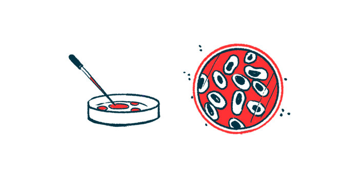 A dropper is seen poised above a petri dish alongside an aerial view of a cell sample.