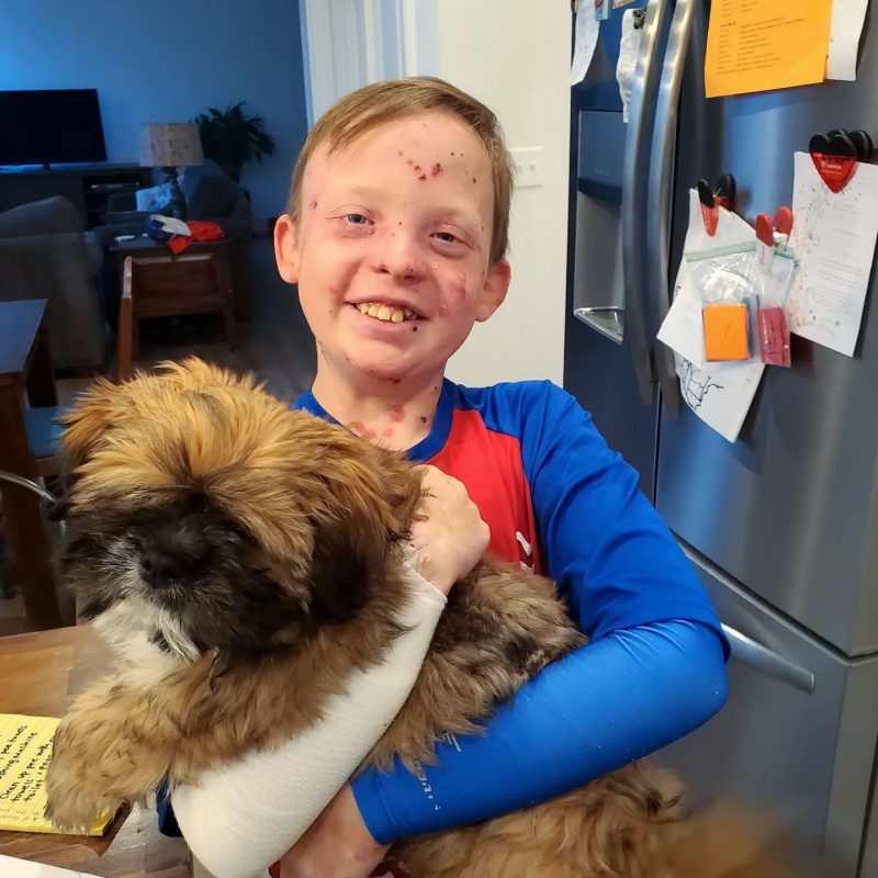Epidermolysis Bullosa News | Jonah, in a red and blue shirt with blue protective sleeves, smiles as he holds an adorable puppy named Muggsy