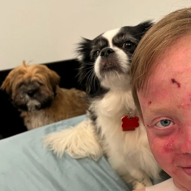 summer heat | Epidermolysis Bullosa News | Jonah smiles for a photo indoors with his two small dogs.