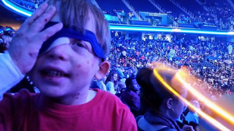 A young boy with epidermolysis bullosa smiles in the audience at "Disney on Ice: Frozen and Friends" in 2014. He's covering his right eye with his hand, as it's bandaged up due to a corneal abrasion.