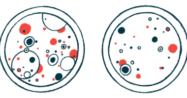 Two petri dishes with different contents are shown side by side.