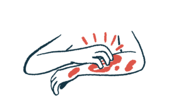 In this close-up illustration, a person uses the right hand to scratch a rash on the left forearm.