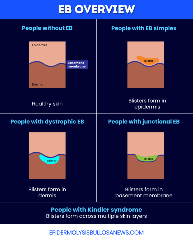 An infographic provides an overview of EB.