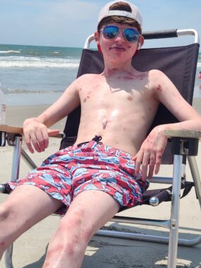 A teenage boy sits on a gray beach chair with the ocean behind him, with waves rolling in. It's clearly a hot and sunny day, and he sits there in his swimming trucks, with a backward baseball cap, mirrored sunglasses, and no shirt. 