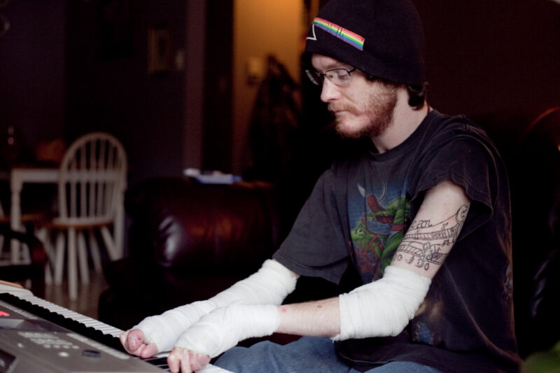 A man plays a keyboard in a dark room. His hands, wrists, and parts of his arms are wrapped in bandages and gauze.